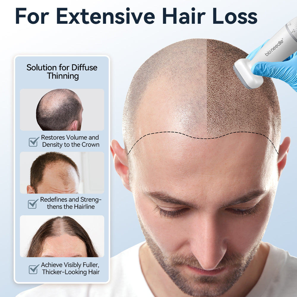 Biopen 120 Hair Growth Microneedle Stamp