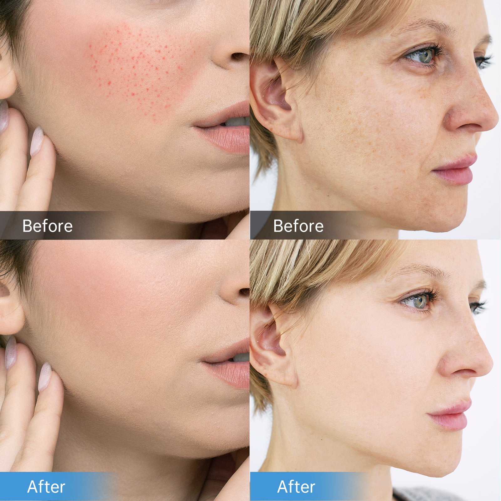 Dr. Pen M8 Professional Microneedling Pen with 12 Cartridges