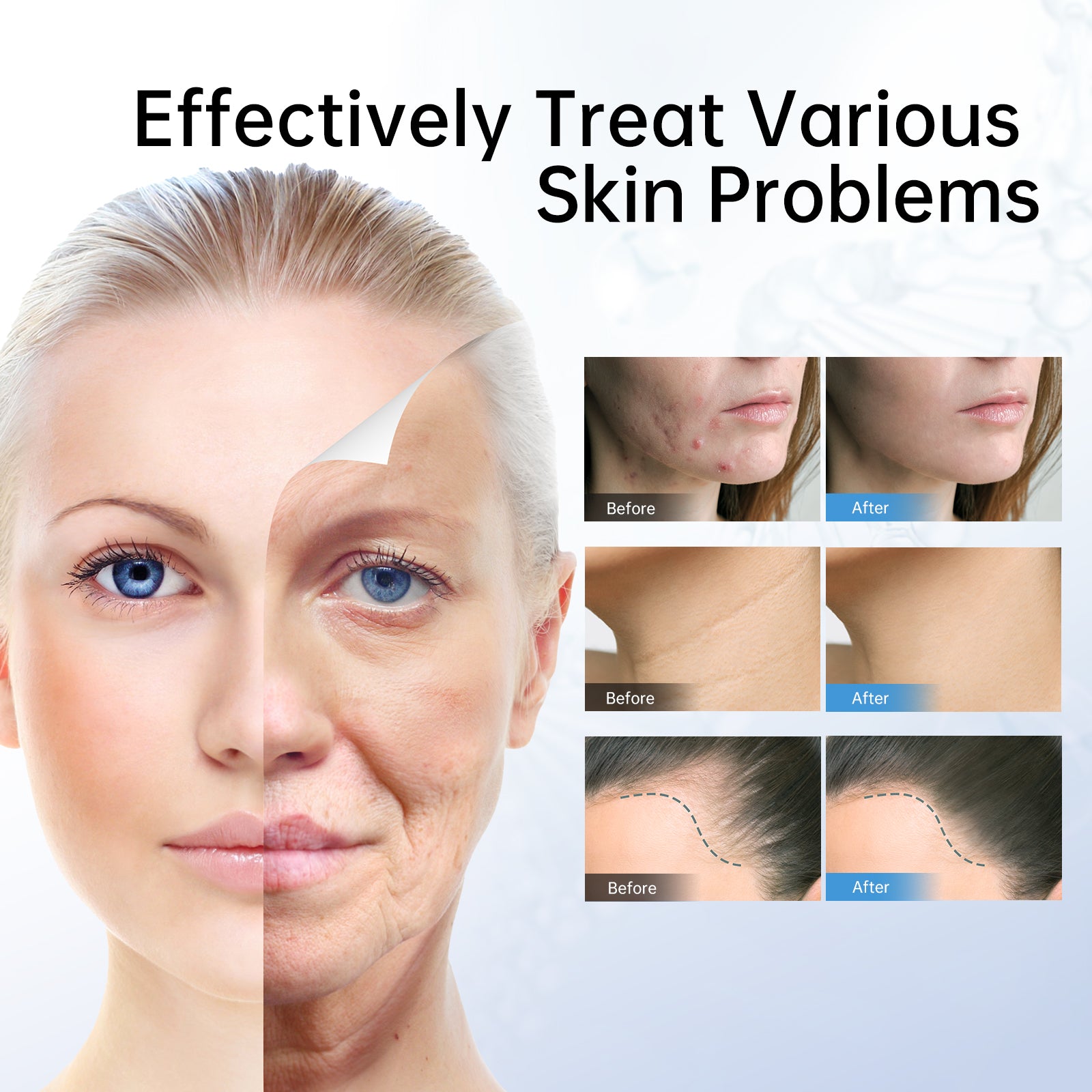 Dr. Pen M8 Professional Microneedling Pen for Home Use