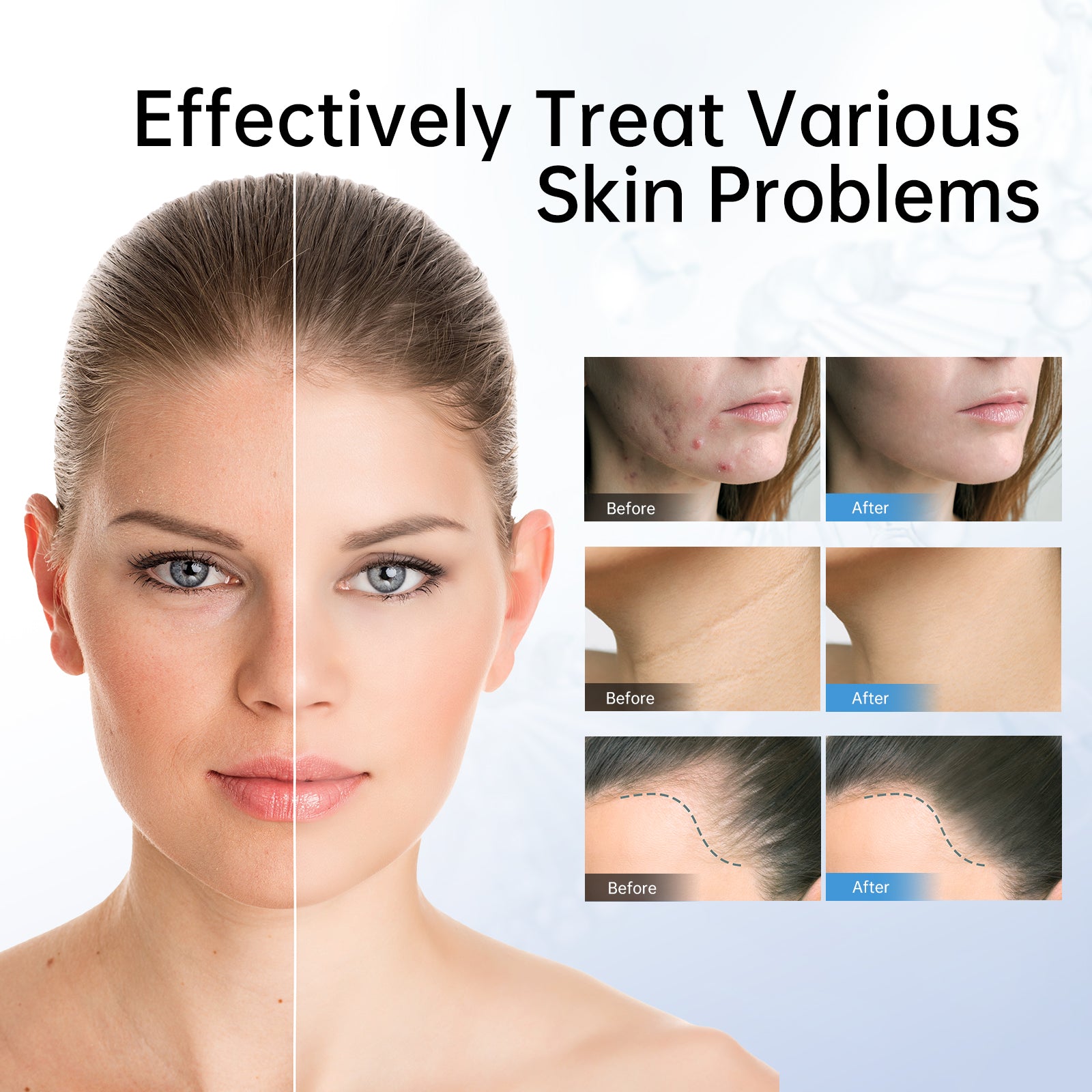 Dr. Pen A11 Ultima PRO Microneedling Pen