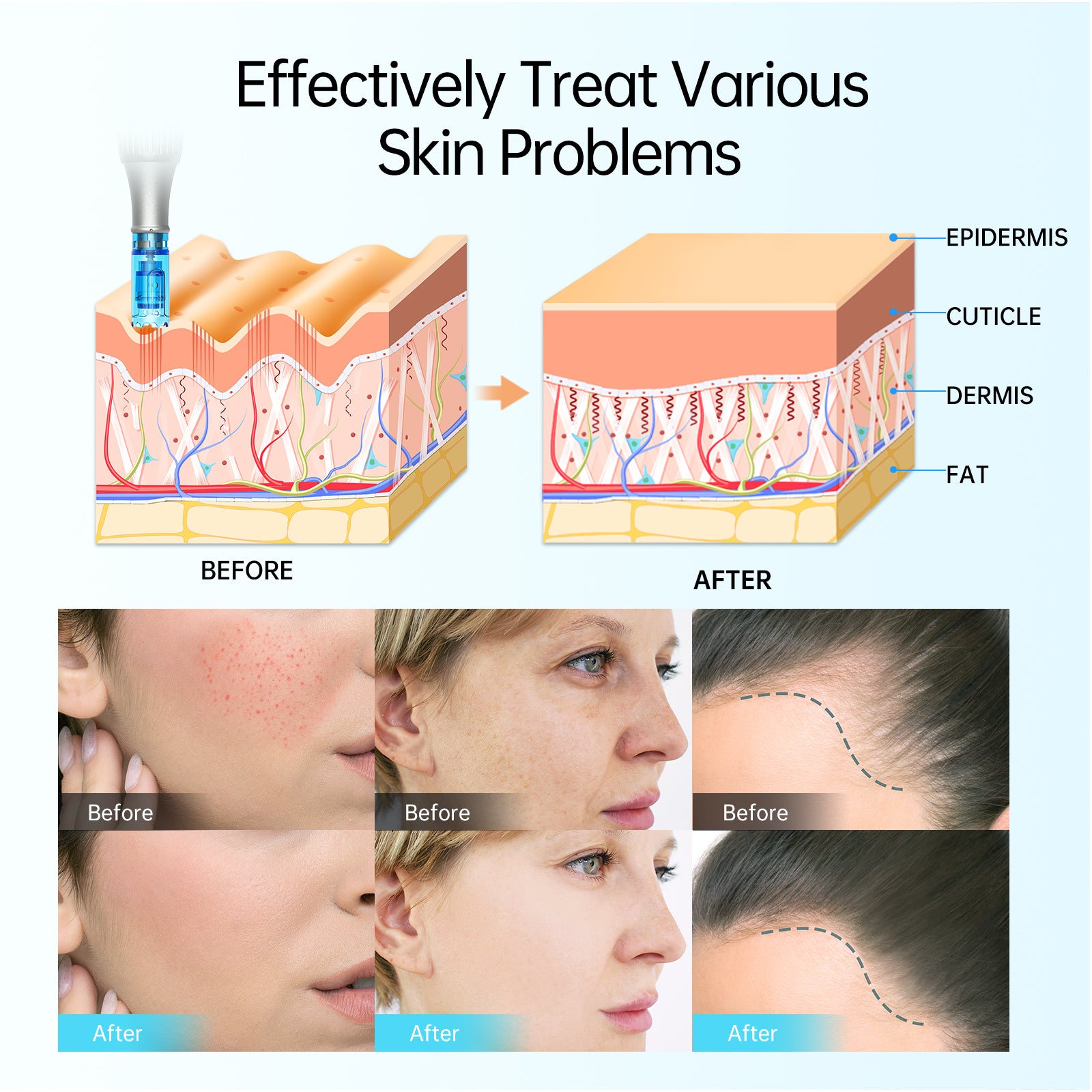 Dr. Pen M8S Microneedling Pen