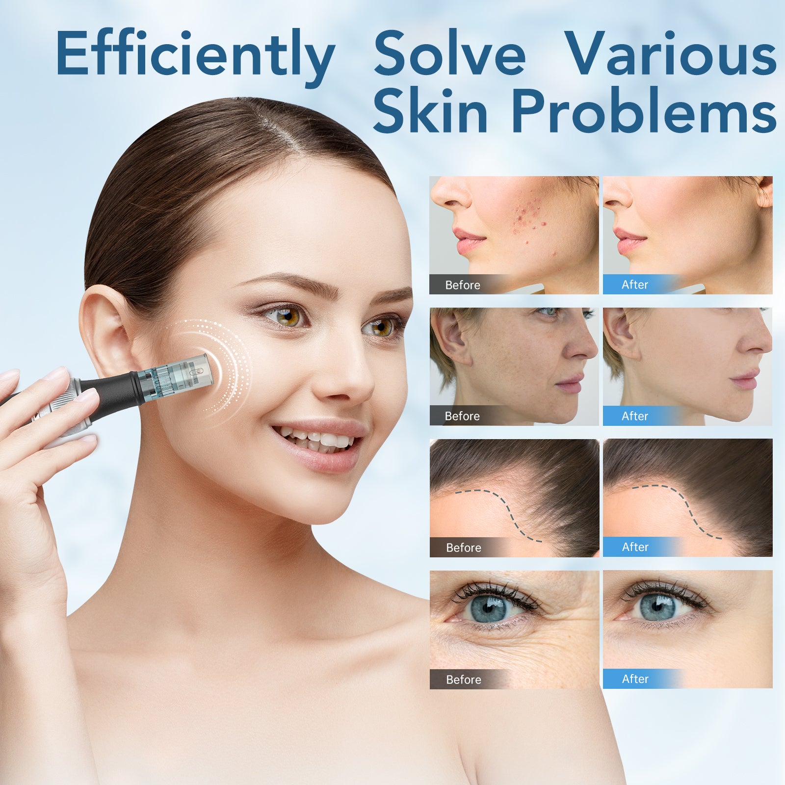 Dr. Pen Ultima M7S Professional Grey Microneedling Pen
