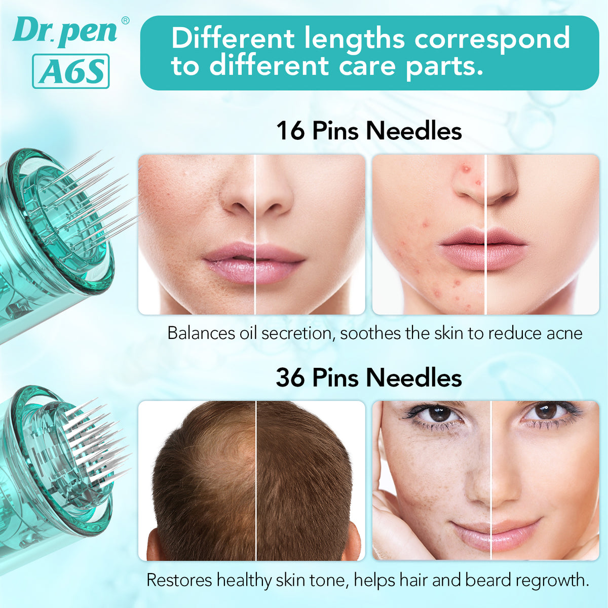 Dr. Pen A6S Microneedling Pen with 16-pin Cartridges 10 pcs