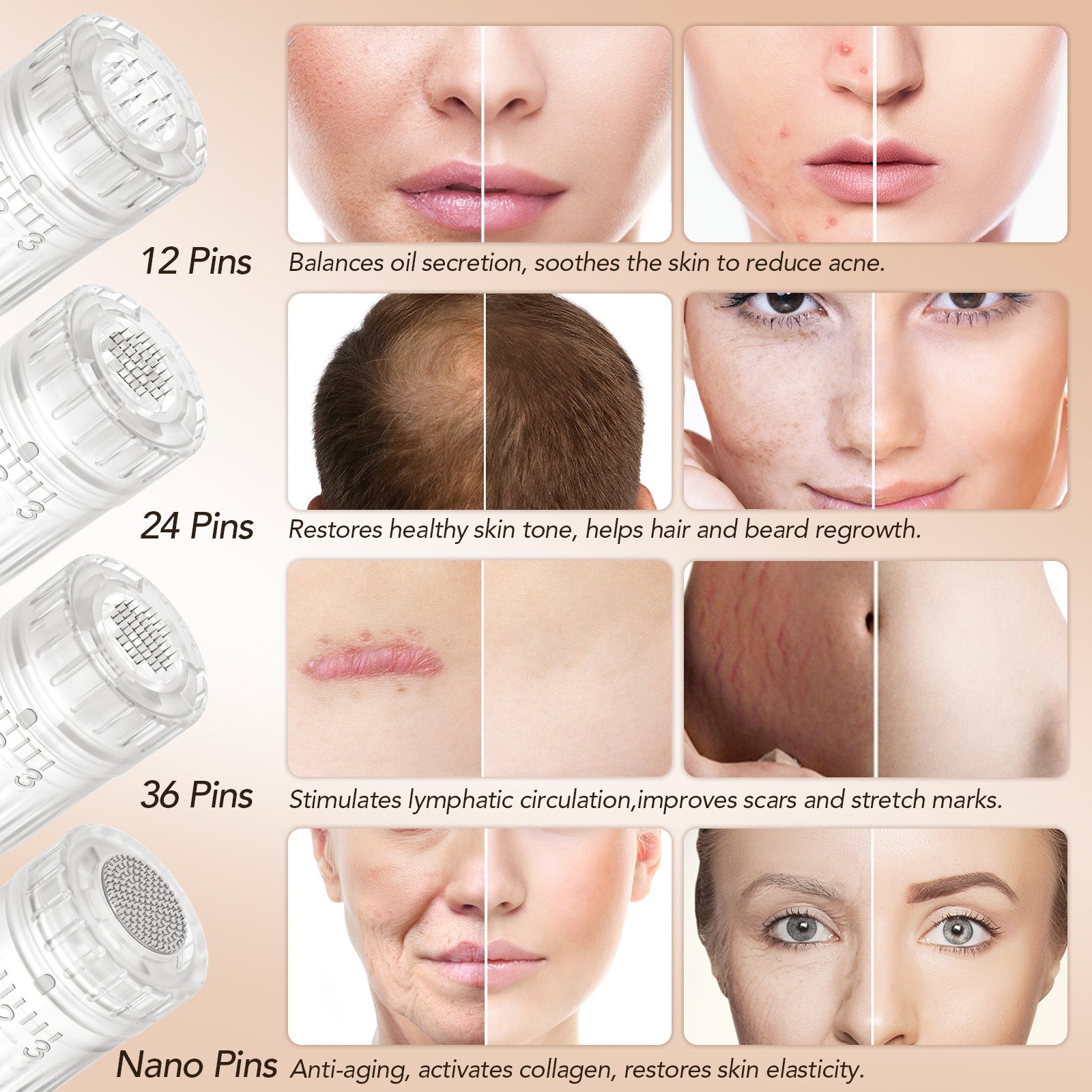 Dr. Pen HydraPen H3 Wireless Serum-Infusion Skincare Microneedling Pen with 20 Cartridges